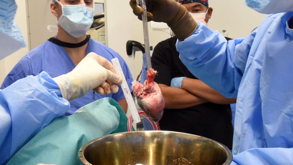 Doctors conduct world's second pig heart transplant into human.