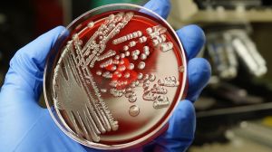 Scientists have discovered some of the most deadly bacteria has a taste for blood. The findings could open the door for new treatments for certain inflammatory bowel diseases.