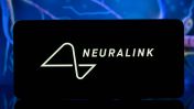 A new report reveals that Neuralink knew of issues with its devices years before the first human patient began experiencing issues.