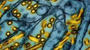 A Canadian teen in critical condition with bird flu, or H5N1, reportedly had no known prior exposure to the infection before the diagnosis.