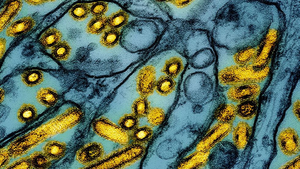 A Canadian teen in critical condition with bird flu, or H5N1, reportedly had no known prior exposure to the infection before the diagnosis.